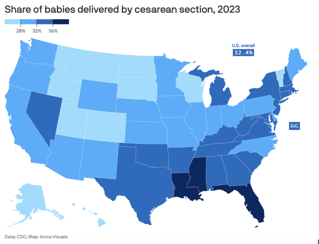 Graph of the US based on c-section rates